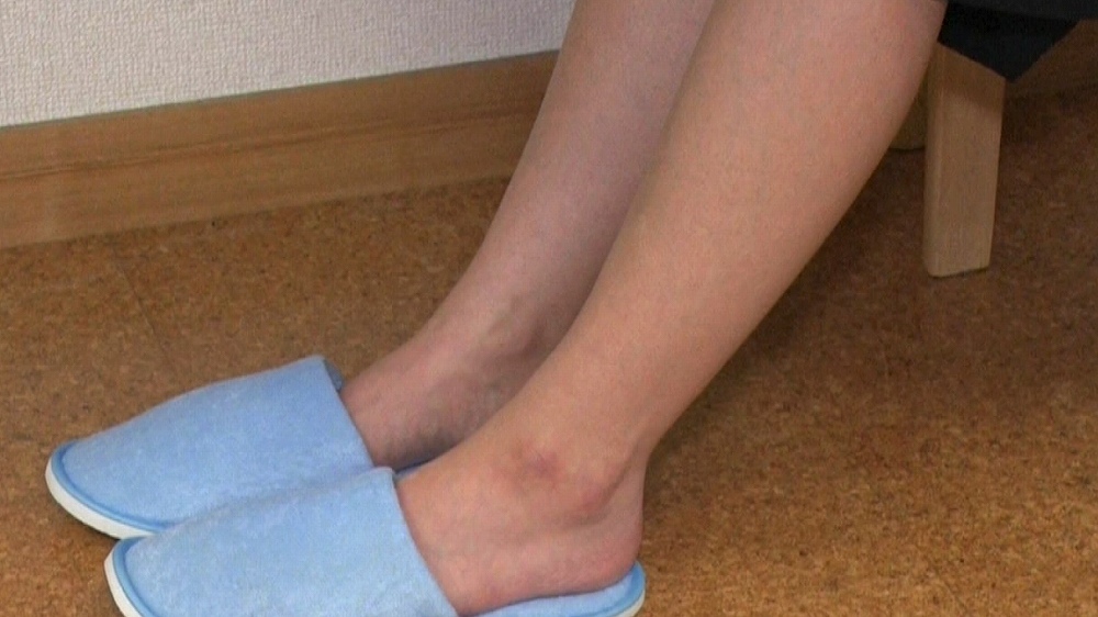 足のむくみは ある部分 が硬くなることで起こるらしい 名医のthe太鼓判 Tbsテレビ