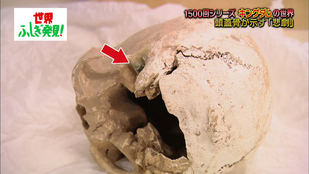 矢が刺さった痕跡のある頭蓋骨