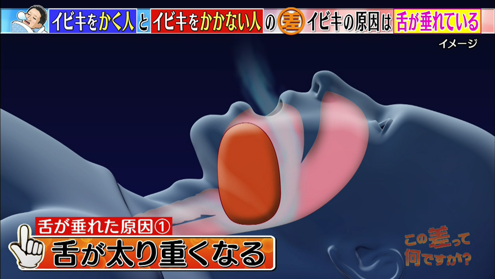 体重が増えると舌も太り重くなる