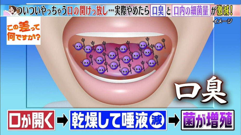 その口 臭ってるかも 口呼吸 がもたらすデメリット この差って何ですか ニュース テレビドガッチ