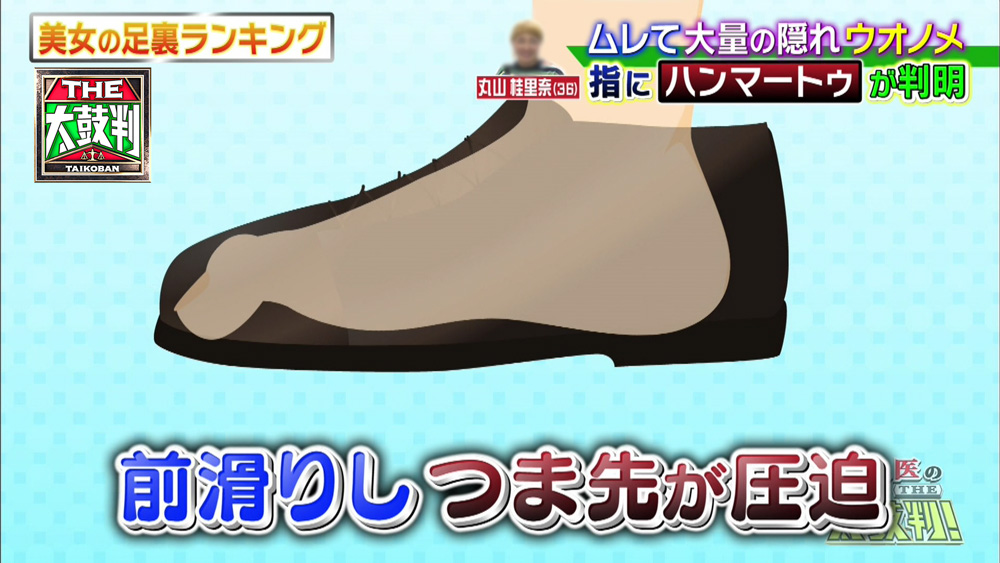 つま先が圧迫されることが原因