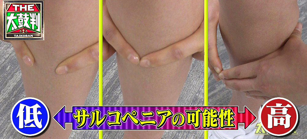 ふくらはぎのチェック
